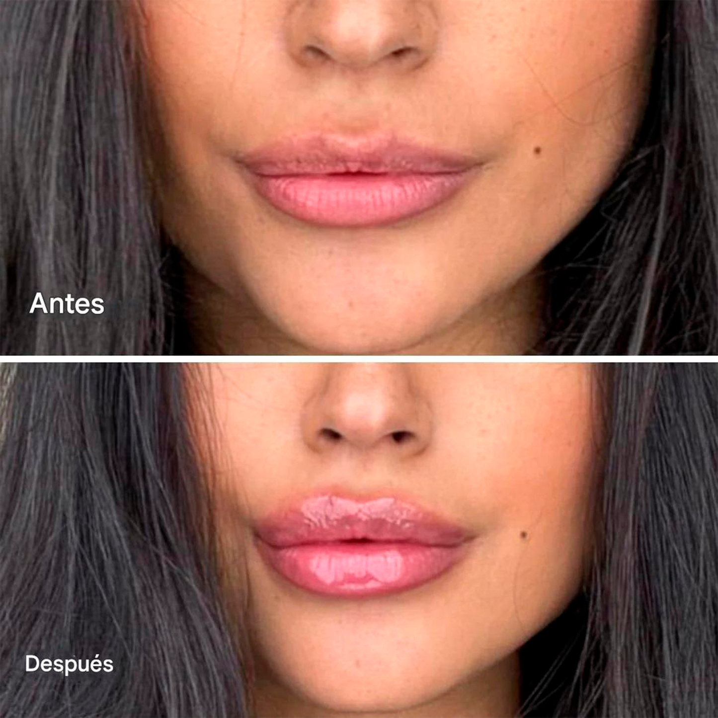 Voluminizador Natural De Labios Kissy™