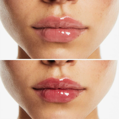 Voluminizador Natural De Labios Kissy™
