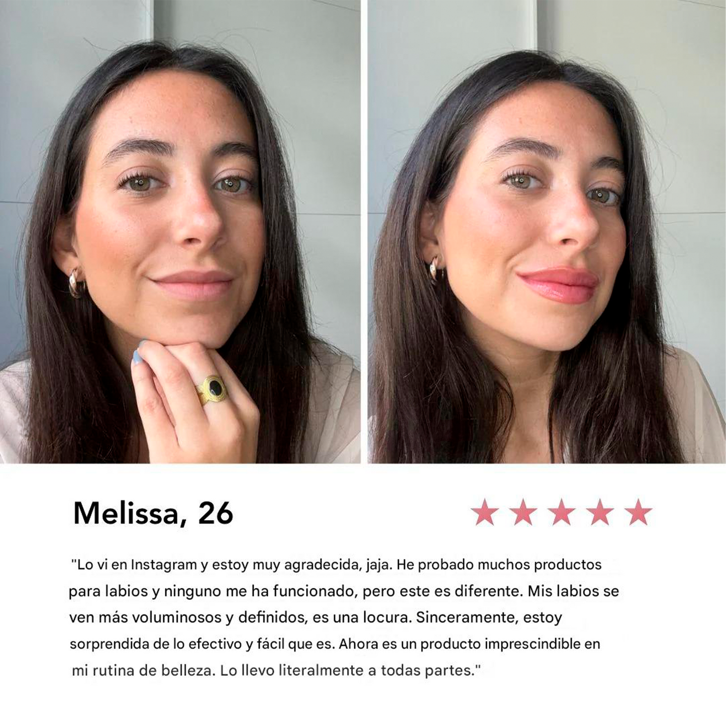 Voluminizador Natural De Labios Kissy™