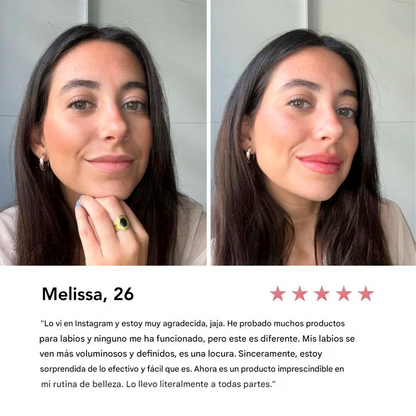 Voluminizador Natural De Labios Kissy™